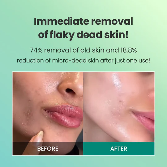 Dr.G Brightening Peeling Gel 120 g