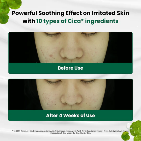 Dr.G Red Blemish Clear Soothing Cream 70ml